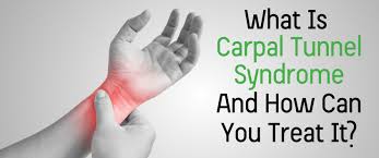 How to treat carpal tunnel syndrome