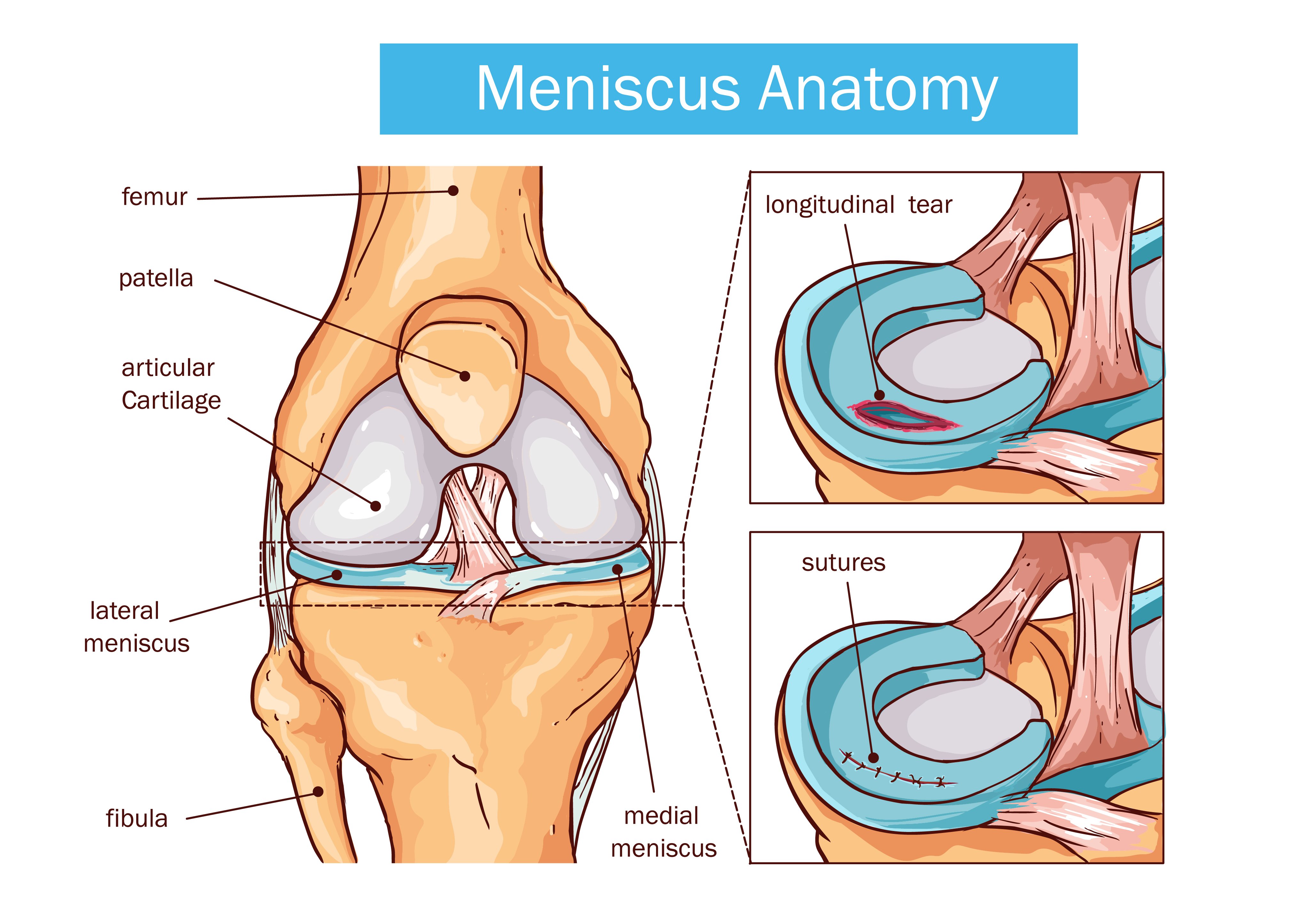 Meniscus Anatomy