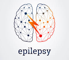 epilepsyImage