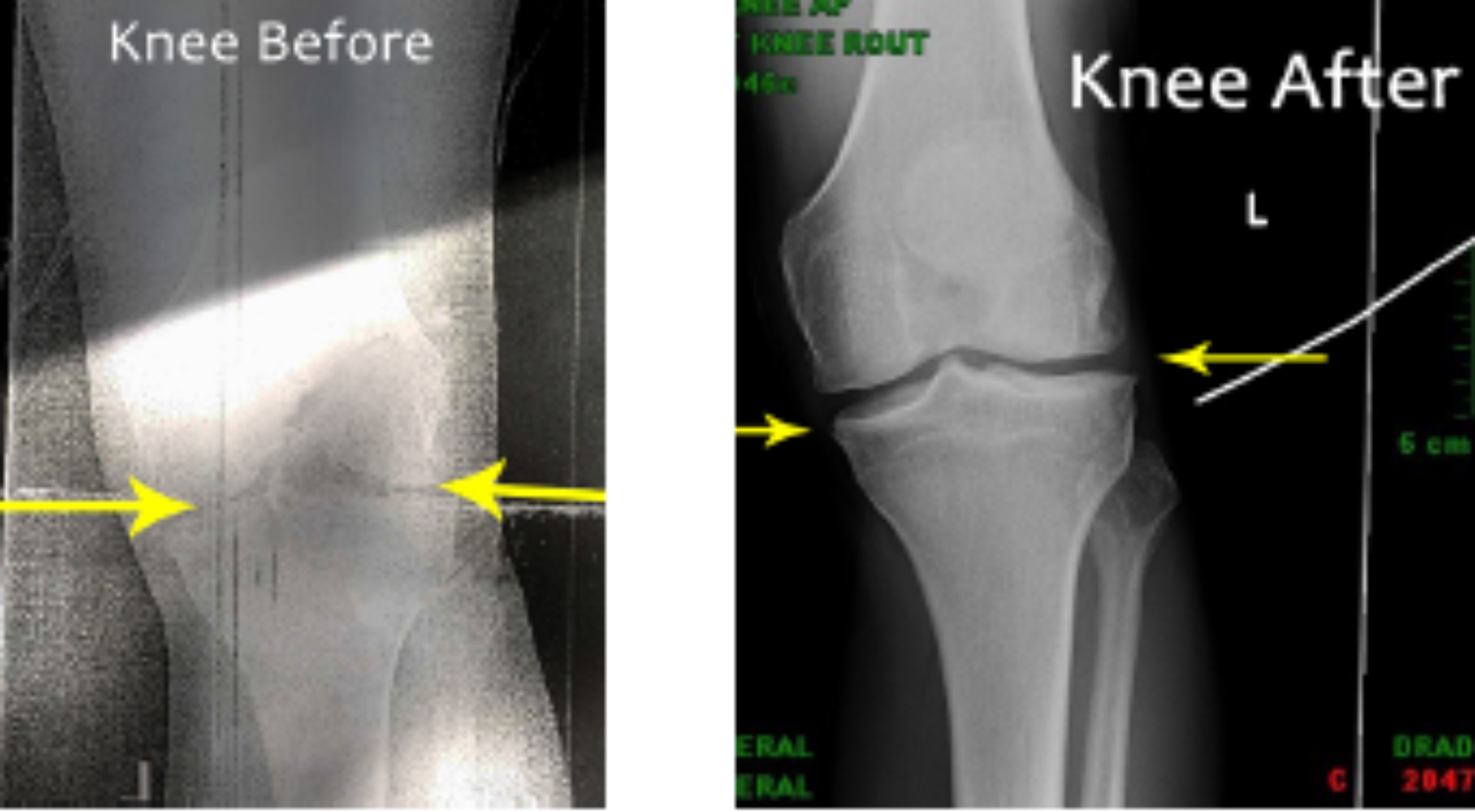 Knee Xrays.jpg